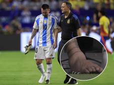 Lesión de Leo Messi: ¿Por cuánto tiempo estará fuera de las canchas el astro argentino por su golpe en el tobillo?