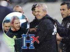 Honduras y el duro castigo que estaría recibiendo por FIFA luego del juego ante México donde hirieron al Vasco Aguirre