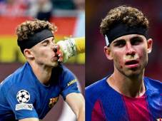 Fermín y la herida que le dejó el encuentro entre el Barcelona y Atlético de Madrid. Fotos cortesía.