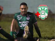 Se confirma el estado de la lesión del defensor hondureño Henry Figueroa.