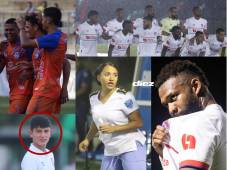 Mira las curiosas imágenes que dejaron los duelos UPNFM vs Génesis y CD Choloma vs Olimpia por la jornada 1 del Apertura 2025-2026 de la Liga Nacional. Fotos Neptalí Romero, Mauricio Ayala y Alex Pérez