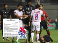 Edwin Rodríguez recibió la tarjeta roja tras propinarle un golpe a Devron García en el Olimpia vs Real España en el Nacional Chelato Uclés. FOTO: Marvin Salgado.