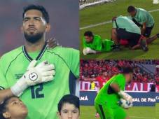 El portero de Panamá sufrió un dolor en pleno partido amistoso entre Panamá contra República Dominicana.