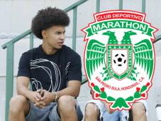 Javier Arriaga se lesionó en noviembre del 2024 y sigue en proceso de recuperación. Foto Neptalí Romero.