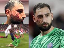 Gianluigi Donnarumma sufrió este miércoles 18 de diciembre una terrible lesión que ha provocado diversos comentarios a nivel mundial.
