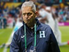 Reinaldo Rueda tiene problemas para los dos juegos de noviembre.
