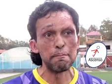 Pedro Joaquín Amador ya habría comenzado pretemporada con club de Liga de Ascenso.