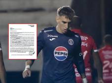 Rodrigo Auzmendi fue castigado de oficio por el escupitajo a Julián Martínez.