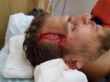 Imagen de la herida compartida por el jugador en sus redes sociales