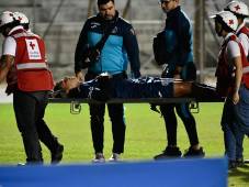 Motagua, preocupado por la lesión de uno de sus jugadores seleccionados: “La rodilla estaba demasiada inflamada”