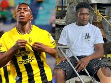 Dixon Ramírez revela cuánto tiempo estará fuera y ¿considera que perjudican a Real España?: Como que lo ignoran a uno