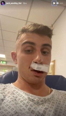 Impactantes imágenes: Ataque brutal a atleta olímpico gay que fue sometido a reconstrucción facial