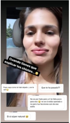 '¿Qué te ha pasado?' Mujer de crack del Real Madrid es atacada por su impactante aumento de labios&nbsp;&nbsp;