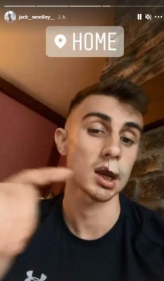 Impactantes imágenes: Ataque brutal a atleta olímpico gay que fue sometido a reconstrucción facial