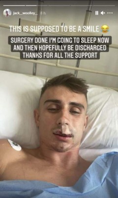 Impactantes imágenes: Ataque brutal a atleta olímpico gay que fue sometido a reconstrucción facial