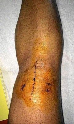 Las espeluznantes y temibles operaciones a los futbolistas