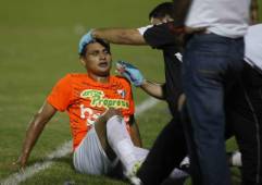 El jugador Johnny Rivera salió afectado después del choque con cabezas que tuvo con el 'Camello' Delgado.