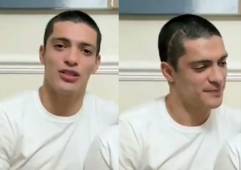 A Raúl Jiménez le quedó una cicatriz en su cráneo producto de la operación a la que fue sometido.