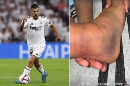 Futbolista del Real Madrid muestra cómo quedó su tobillo: “Un día menos para volver”