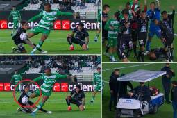 Lucas Romero recibió una patada en la cara de Harold Precia, una jugada totalmente accidental en el León-Santos Laguna.
