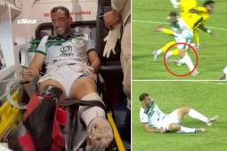 Fabricio Silva sufre espantosa lesión en el Real España-Juticalpa que se disputó en el Morazán