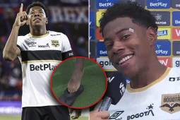 Dereck Moncada muestra el golpe que sufrió tras marcar doblete en Colombia y confiesa: Él es mi referente, sigo sus pasos