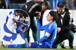 Guillermo Ochoa salió lesionado de su hombro derecho durante el Honduras-México disputado en el Nacional.