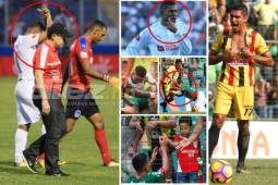 Te mostramos el momento en el que se lesiona Donis Escober, los reclamos de Jorge 'Pitbull' Claros y el gesto obsceno de Carlo Costly. Todo esto dejó la jornada 14 de Liga Nacional.