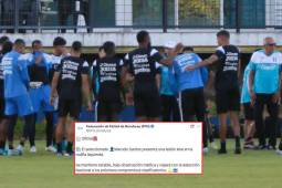 La Federación de Fútbol de Honduras informó sobre la lesión de Marcelo Santos previo al partido contra Nicaragua.