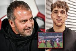 Hansi Flick valora la goleada del Barça y bromea con la patada de Cubarsí: “Es joven, solo son unas grapas en su cara”