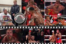 La pelea organizada por Netflix tuvo como claro ganador al boxeador británico y el youtuber estadounidense mostró en redes sociales el resultado de la lesión sufrida.