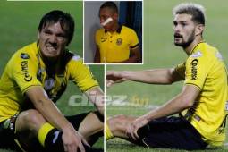 Matías Soto y Delis Vargas estarían volviendo antes de lo previsto en Real España y no están descartados para el derbi con Marathón. El joven Miguel Carrasco sí es un hecho que no estará.