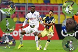 Duras faltas que se dieron en el América-Olimpia