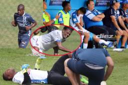 La Selección de Honduras pierde seis jugadores titulares por lesión y dos por acumulación de amarillas. Jorge Luis Pinto tiene una tarea complicada.