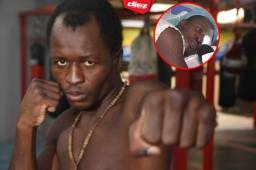 'Muñeco' González pide que lo ayuden para operarse de un ojo.