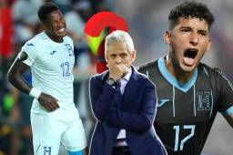 La Selección de Honduras debe hacer cambios en su convocatoria para medirse a México el próximo viernes 17 y martes 21 de noviembre.