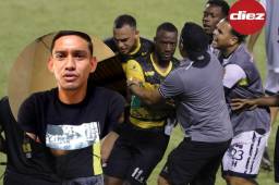 Daniel Meléndez desmiente las declaraciones de Darixon Vuelto, que afirma que le llamaron “mono”. Foto: Neptalí Romero.