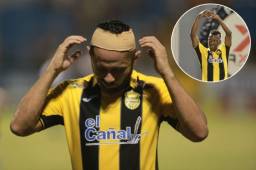 AlfredoMejía y Darixon Vuelto no tienen nada serio y podrían jugar ante Honduras Progreso.