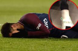 Neymar sufrió un esguince de tobillo en el triunfo sobre el Marsella.