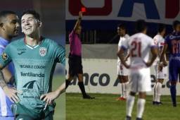 Pedro Troglio pierde a Johnny Leverón para el clásico ante Motagua y la visita ante Real de Minas. Ryduan Palermo recibió el castigo automático (1 partido).