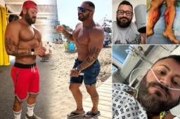 El culturista Dante McNulty se salvó de milagro gracias a su asistente virtual cuando se dirigía a pasear a su perro. Rodó por las escaleras y estuvo varias horas sin conocimiento.