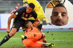 Sorrentino se refirió al fuerte impacto con Cristiano Ronaldo en la primera fecha de la Serie A.