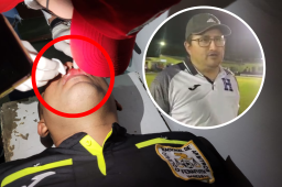 Lamentable: Suspenden el Real Juventud-Olimpia Occidental por agresión en el rostro a árbitro asistente