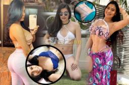 Alejandra Rubio, bella presentadora del canal Q'Hubo TV, luce en sus redes sociales el cuerpo tras unas cirugías plásticas a las cuales se sometió.