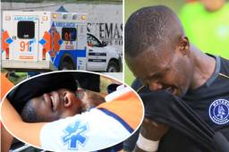 El delantero Rubilio Castillo ha sumado una nueva lesión en su carrera, esta vez le han fracturado su pómulo derecho tras un codazo del jugador Ronald García de Real de Minas.