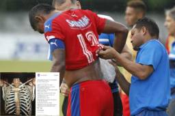 El delantero Carlo Costly tiró una dura indirecta en redes sociales a quien lo lesionó en el juego ante Marathón.