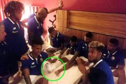 Alberto Quintero recibió el apoyo de sus compañeros de selección tras conocer que la lesión lo deja fuera de Rusia 2018.