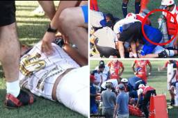 Jugador de Potros de Olancho fue llevado de emergencia a un centro médico tras sufrir fuerte golpe en la cabeza.