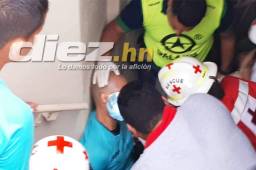 Gerson Matute fue agredido en La Ceiba durante el Vida-Juticalpa.