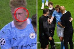 Así le quedó el rostro de Kevin De Bruyne tras un tremendo golpe recibido por Rudiger.